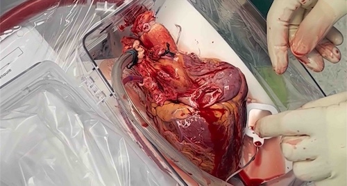 Pressebild aus Sterben für Anfänger - Herz